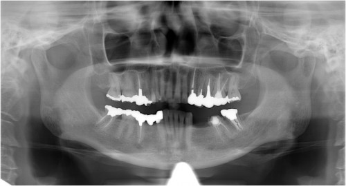 西本１　初診時